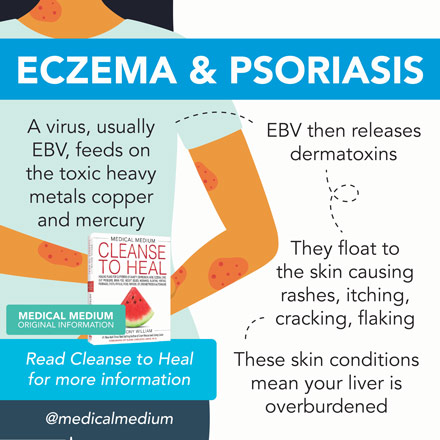 Eczema & Psoriasis