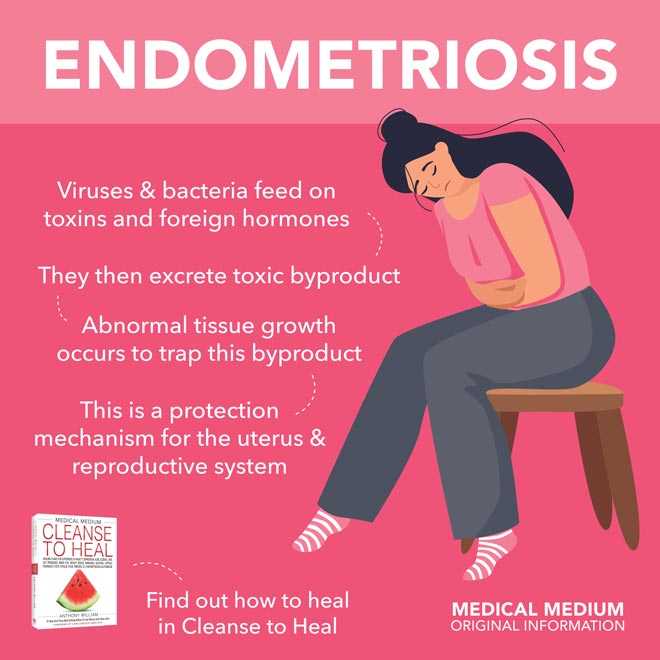 Endometriosis