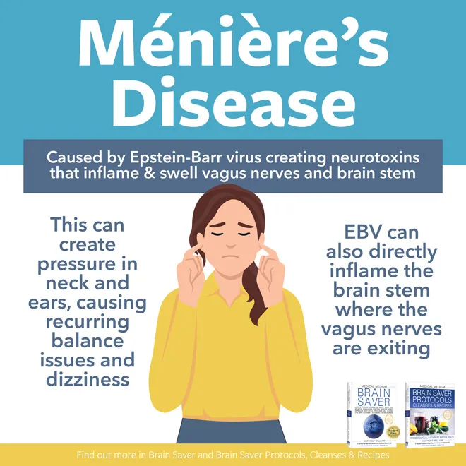 Ménière’s Disease