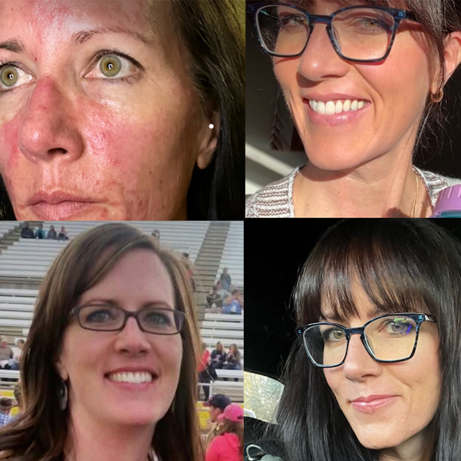 Weight, Skin, Hair & Vision Before & After Medical Medium