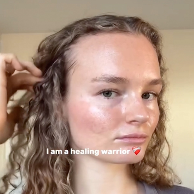 Before & After Skin